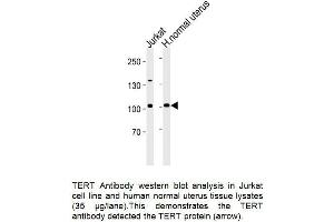 Image no. 1 for anti-Telomerase Reverse Transcriptase (TERT) (AA 1104-1132) antibody (ABIN1981423)