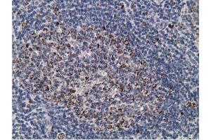 Image no. 5 for anti-Synovial Sarcoma, X Breakpoint 1 (SSX1) antibody (ABIN1501156)