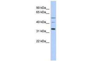 Image no. 1 for anti-T-Complex 11, Testis-Specific (TCP11) (AA 143-192) antibody (ABIN6743759)