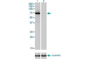 Image no. 1 for anti-Coagulation Factor II (thrombin) (F2) (AA 263-362) antibody (ABIN560822)
