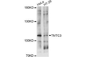 anti-Transmembrane and Tetratricopeptide Repeat Containing 3 (TMTC3) antibody