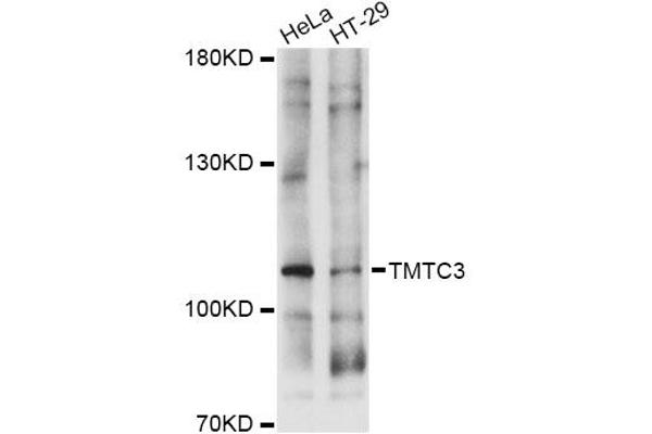 anti-Transmembrane and Tetratricopeptide Repeat Containing 3 (TMTC3) antibody