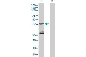 Image no. 1 for anti-serine/threonine Kinase 19 (STK19) (AA 1-364) antibody (ABIN522323)