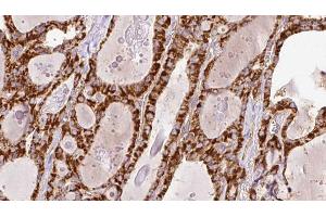 Image no. 1 for anti-Ryanodine Receptor 2 (Cardiac) (RYR2) (Internal Region) antibody (ABIN6264892)