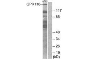 G Protein-Coupled Receptor 116 antibody  (AA 11-60)