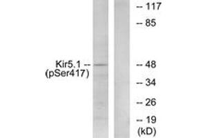 Image no. 1 for anti-Potassium Inwardly-Rectifying Channel, Subfamily J, Member 16 (KCNJ16) (AA 369-418), (pSer417) antibody (ABIN1531680)