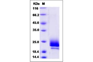 Image no. 1 for Marginal Zone B and B1 Cell-Specific Protein (MZB1) (AA 1-185) protein (His tag) (ABIN2006622)