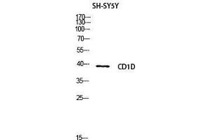 Image no. 5 for anti-CD1d Molecule (CD1D) (Internal Region) antibody (ABIN3181003)
