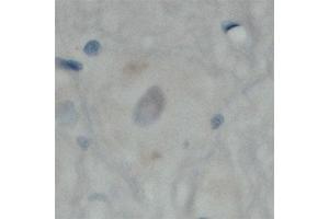 Image no. 1 for anti-Mal, T Cell Differentiation Protein 2 (MAL2) (C-Term) antibody (ABIN350437)