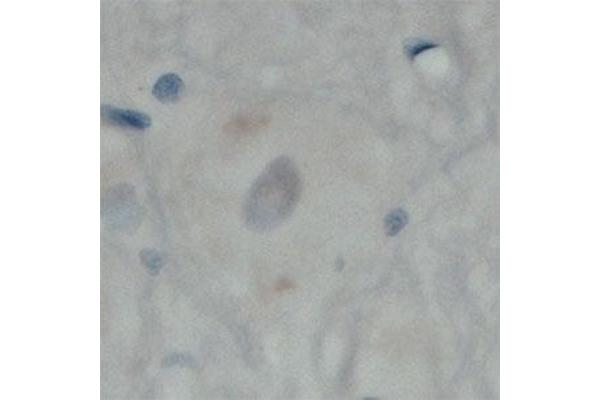 MAL2 antibody  (C-Term)