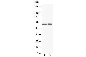 Image no. 1 for anti-Flavin Containing Monooxygenase 3 (FMO3) (N-Term) antibody (ABIN3030969)