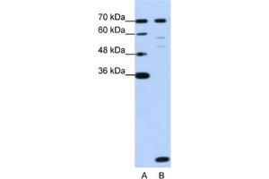 Image no. 1 for anti-LSM2 Homolog, U6 Small Nuclear RNA Associated (LSM2) antibody (ABIN2462291)