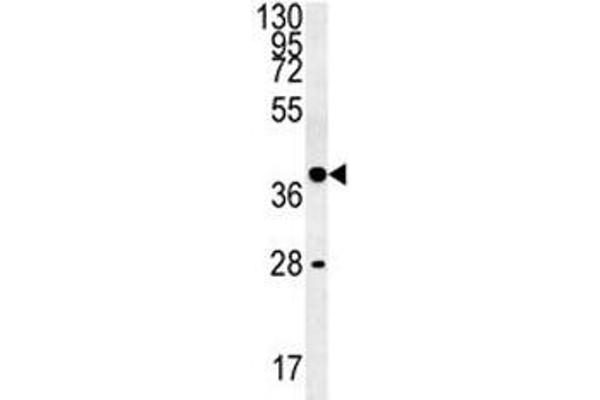 WNT8B antibody  (AA 323-351)