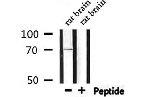 Image no. 3 for anti-Protein S (PROS) (N-Term) antibody (ABIN6264441)