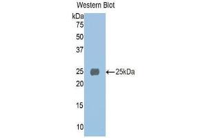 Image no. 1 for anti-alpha 1 Microglobulin/bikunin precursor (AMBP) (AA 20-202) antibody (ABIN1077776)