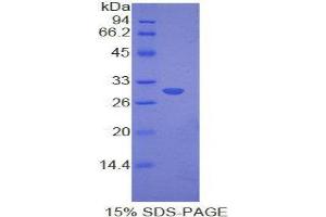 Image no. 1 for Myosin IE (MYO1E) (AA 772-1033) protein (His tag) (ABIN1878000)