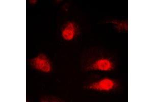Image no. 1 for anti-Synaptotagmin Binding, Cytoplasmic RNA Interacting Protein (SYNCRIP) (Center) antibody (ABIN2706324)