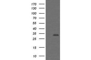 Image no. 1 for anti-Proteasome (Prosome, Macropain) Inhibitor Subunit 1 (PI31) (PSMF1) antibody (ABIN1500490)