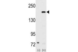 Image no. 1 for anti-Nuclear Receptor Coactivator 1 (NCOA1) (AA 186-214) antibody (ABIN3032056)