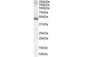 Image no. 2 for anti-Retinoic Acid Receptor, alpha (RARA) (C-Term) antibody (ABIN185366)