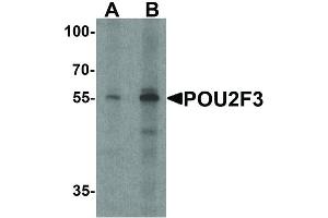 Image no. 2 for anti-POU Class 2 Homeobox 3 (POU2F3) (C-Term) antibody (ABIN6656906)