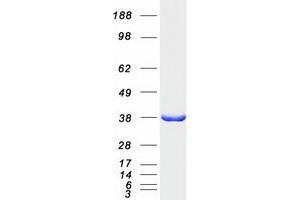 Image no. 1 for Glutaredoxin 3 (GLRX3) protein (Myc-DYKDDDDK Tag) (ABIN2722018)