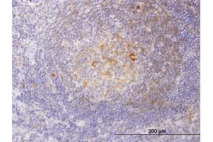 Image no. 1 for anti-Regulatory Solute Carrier Protein, Family 1, Member 1 (RSC1A1) (AA 1-100) antibody (ABIN562748)