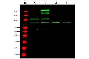 Western blot using  Protein A Purified anti-RREB1 antibody shows detection of a predominant band believed to be RREB1 in various cell lysates (1 - HEK293, 2 - RFP-RREB transfected HEK293, 3 - M460 and 4 - T1165).