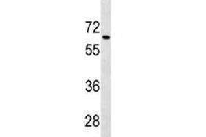 Image no. 3 for anti-Transforming Growth Factor, beta Receptor II (70/80kDa) (TGFBR2) (AA 548-575) antibody (ABIN3029225)