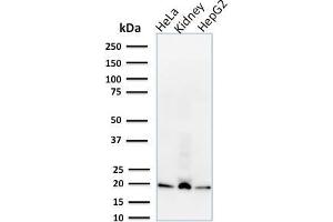 Image no. 1 for anti-ADP-Ribosylation Factor 1 (ARF1) (C-Term) antibody (ABIN6939844)
