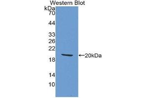 Image no. 1 for anti-Heparin-Binding EGF-Like Growth Factor (HBEGF) (AA 25-160) antibody (ABIN1859126)