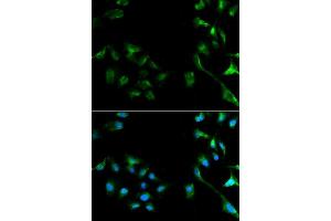 Image no. 2 for anti-Mitogen-Activated Protein Kinase 1 (MAPK1) (N-Term) antibody (ABIN3020728)