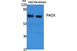 anti-Polyamine Oxidase (Exo-N4-Amino) (PAOX) (Internal Region) antibody