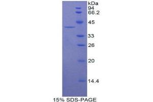 Image no. 1 for Keratin 16 (KRT16) protein (His tag) (ABIN1080128)