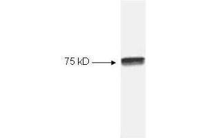 Image no. 3 for anti-Nuclear Factor kappa B (NFkB) antibody (ABIN965403)
