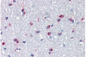 Image no. 1 for anti-Pituitary Homeobox 3 (PITX3) (N-Term) antibody (ABIN1495362)