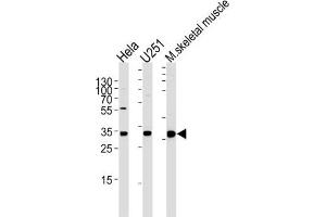 Image no. 1 for anti-Polymerase (RNA) II (DNA Directed) Polypeptide C, 33kDa (POLR2C) antibody (ABIN3004732)