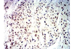 CDX2 antibody  (AA 1-180)