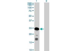 Image no. 2 for anti-Cyclin-Dependent Kinase Inhibitor 1B (p27, Kip1) (CDKN1B) (AA 1-198) antibody (ABIN514294)