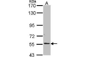 Image no. 4 for anti-Alkaline Phosphatase, Placental-Like 2 (ALPPL2) (Center) antibody (ABIN2856956)