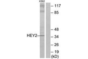 Image no. 1 for anti-Hairy/enhancer-of-Split Related with YRPW Motif 2 (HEY2) (AA 21-70) antibody (ABIN1534166)