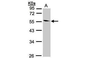 Image no. 3 for anti-Coronin, Actin Binding Protein, 1B (CORO1B) (Center) antibody (ABIN2856445)