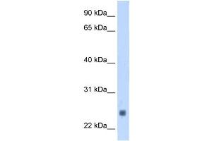 Image no. 1 for anti-Fast Skeletal Troponin I (TNNI2) antibody (ABIN629866)