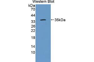 Image no. 2 for anti-Interleukin 20 Receptor alpha (IL20RA) (AA 273-543) antibody (ABIN5013794)