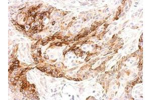 IHC-P Image Galanin Receptor 2 antibody detects GALR2 protein at membrane on Cal27 xenograft by immunohistochemical analysis.