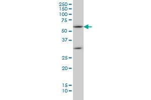 Image no. 2 for anti-Suppressor of Cytokine Signaling 5 (SOCS5) (AA 1-110) antibody (ABIN564173)