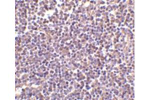 Image no. 2 for anti-CD5 Molecule-Like (CD5L) (N-Term) antibody (ABIN318737)