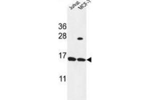 Image no. 1 for anti-Small Proline Rich Protein 1A (SPRR1A) (AA 60-89), (C-Term) antibody (ABIN954941)