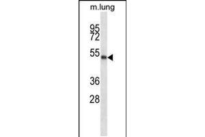 Image no. 2 for anti-Pre-B-Cell Leukemia Homeobox Protein 2 (PBX2) (AA 181-210) antibody (ABIN5533523)
