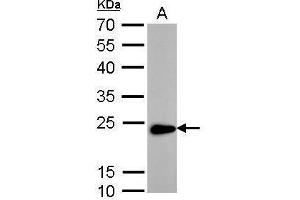 Image no. 5 for anti-Transgelin (TAGLN) (Center) antibody (ABIN2855103)